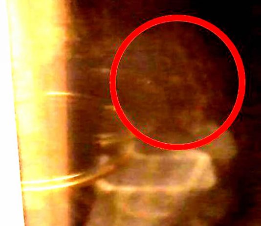 Un hombre reportó a MUFON una fotografía de un supuesto extraterrestre gris.