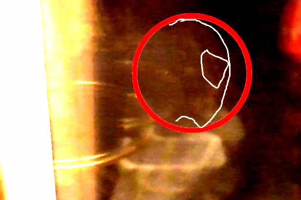 Imagen del supuesto extraterrestre gris. Se han hecho unos trazos para indicar la forma de la cabeza y la posición del supuesto ojo almendrado.